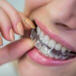 Invisalign Packages