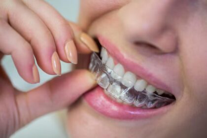 Invisalign Packages